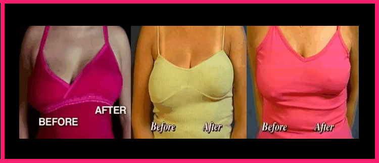 adidas molded techfit bra for sagging breasts