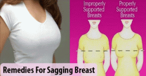 sagging breasts.2pg