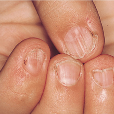 unpainted nails